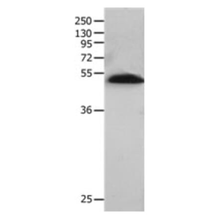 BPIFB2 Antibody from Signalway Antibody (31230) - Antibodies.com
