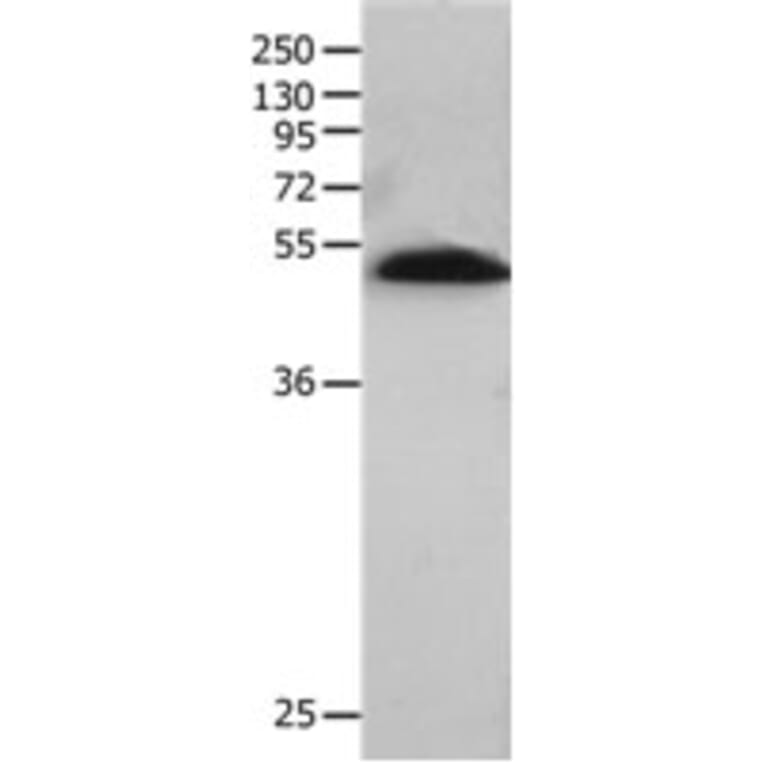 BPIFB2 Antibody from Signalway Antibody (31230) - Antibodies.com