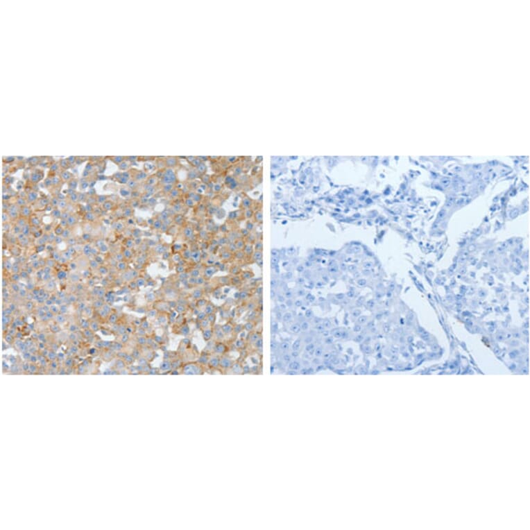 BPIFB2 Antibody from Signalway Antibody (31230) - Antibodies.com