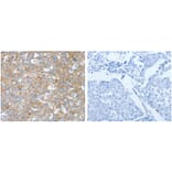 BPIFB2 Antibody from Signalway Antibody (31230) - Antibodies.com