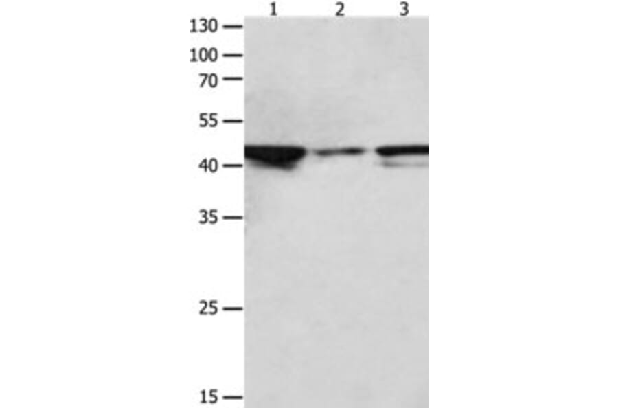 MAP2K2 Antibody from Signalway Antibody (31232) - Antibodies.com