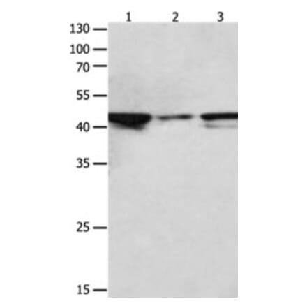 MAP2K2 Antibody from Signalway Antibody (31232) - Antibodies.com