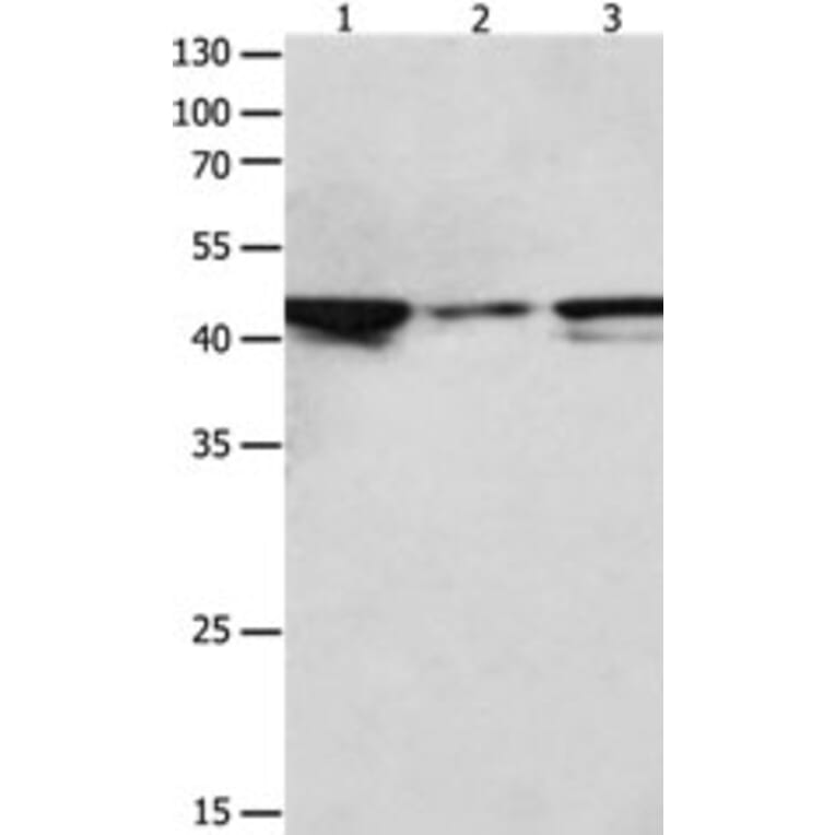 MAP2K2 Antibody from Signalway Antibody (31232) - Antibodies.com