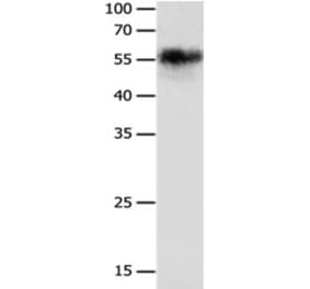 CHRNA3 Antibody from Signalway Antibody (31245) - Antibodies.com