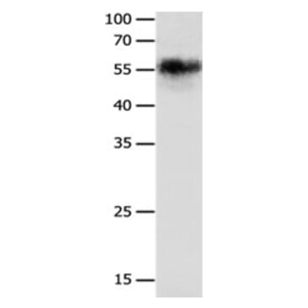 CHRNA3 Antibody from Signalway Antibody (31245) - Antibodies.com