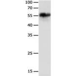 CHRNA3 Antibody from Signalway Antibody (31245) - Antibodies.com
