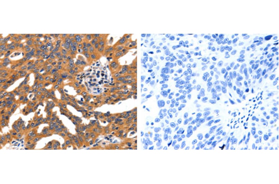 CHRNA3 Antibody from Signalway Antibody (31245) - Antibodies.com