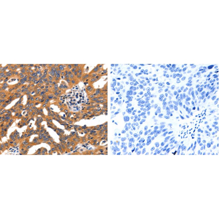 CHRNA3 Antibody from Signalway Antibody (31245) - Antibodies.com