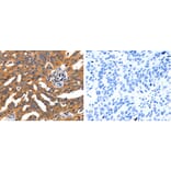 CHRNA3 Antibody from Signalway Antibody (31245) - Antibodies.com