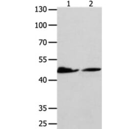 P2RY11 Antibody from Signalway Antibody (31254) - Antibodies.com