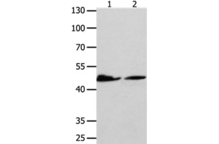 P2RY11 Antibody from Signalway Antibody (31254) - Antibodies.com