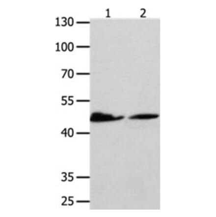P2RY11 Antibody from Signalway Antibody (31254) - Antibodies.com
