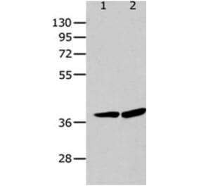 P2RY12 Antibody from Signalway Antibody (31255) - Antibodies.com