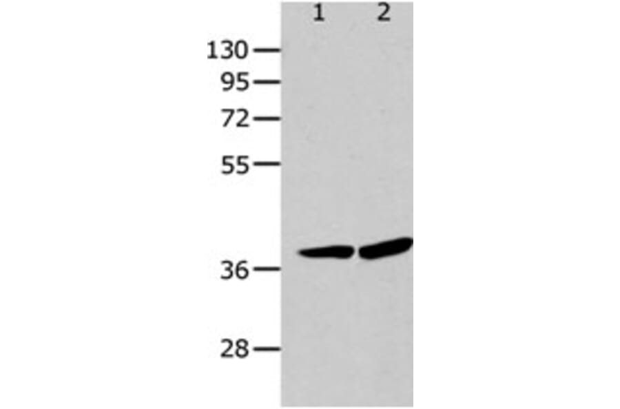 P2RY12 Antibody from Signalway Antibody (31255) - Antibodies.com