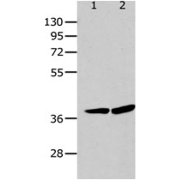 P2RY12 Antibody from Signalway Antibody (31255) - Antibodies.com