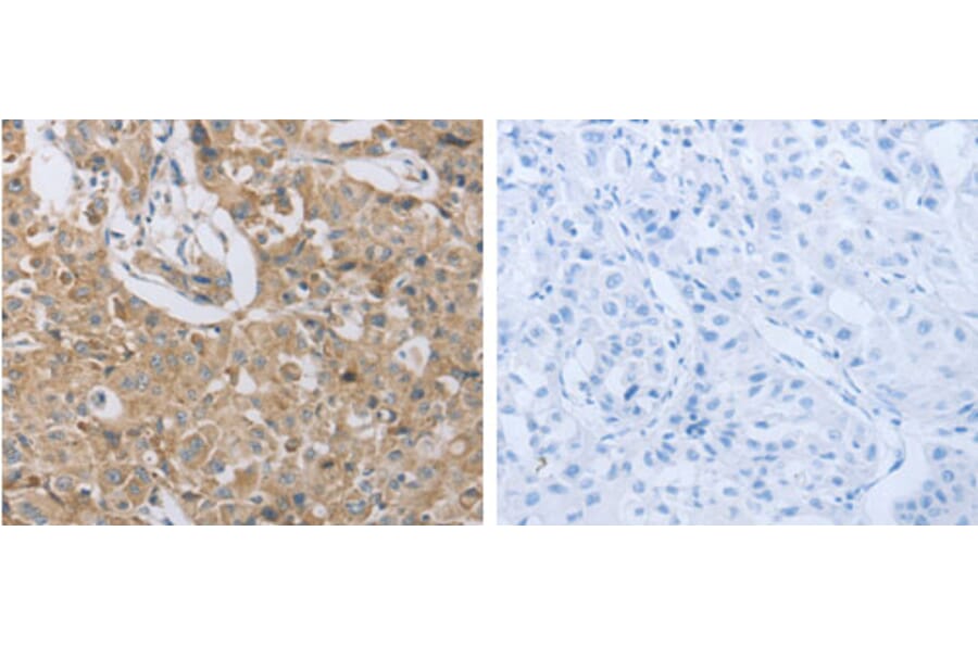 P2RY12 Antibody from Signalway Antibody (31255) - Antibodies.com