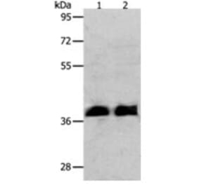 RNF126 Antibody from Signalway Antibody (31265) - Antibodies.com