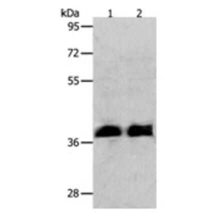 RNF126 Antibody from Signalway Antibody (31265) - Antibodies.com