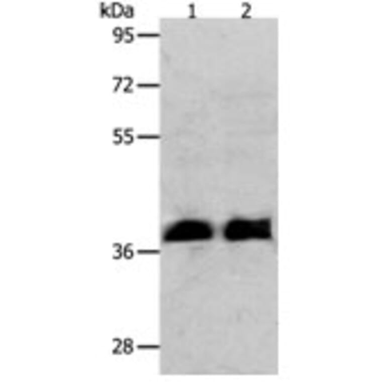 RNF126 Antibody from Signalway Antibody (31265) - Antibodies.com