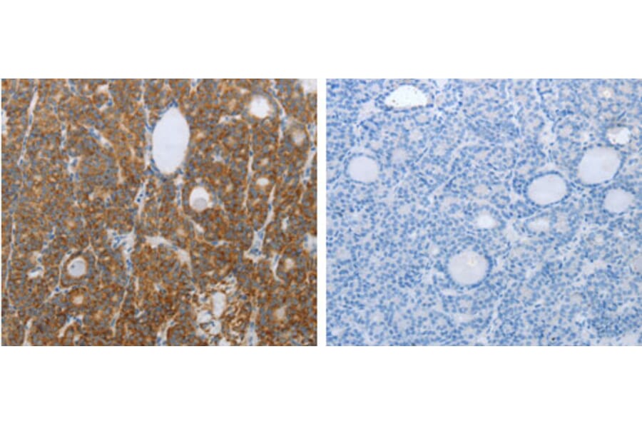RNF126 Antibody from Signalway Antibody (31265) - Antibodies.com