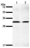 Gel: 10% SDS-PAGE Lane1: K562 cell lysate Lane2: Hela cell lysate. Lysates: 40 µg per lane. Primary antibody: 1/400 dilution. Secondary antibody: Goat anti Rabbit IgG - H&L (HRP) at 1/10000 dilution. Exposure time: 2 minutes