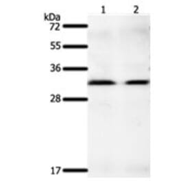 GEMIN2 Antibody from Signalway Antibody (31266) - Antibodies.com