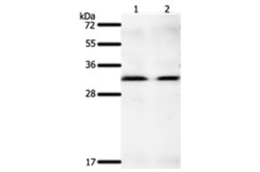 GEMIN2 Antibody from Signalway Antibody (31266) - Antibodies.com