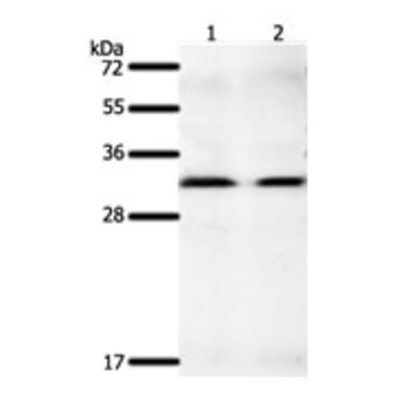 GEMIN2 Antibody from Signalway Antibody (31266) - Antibodies.com