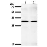 GEMIN2 Antibody from Signalway Antibody (31266) - Antibodies.com