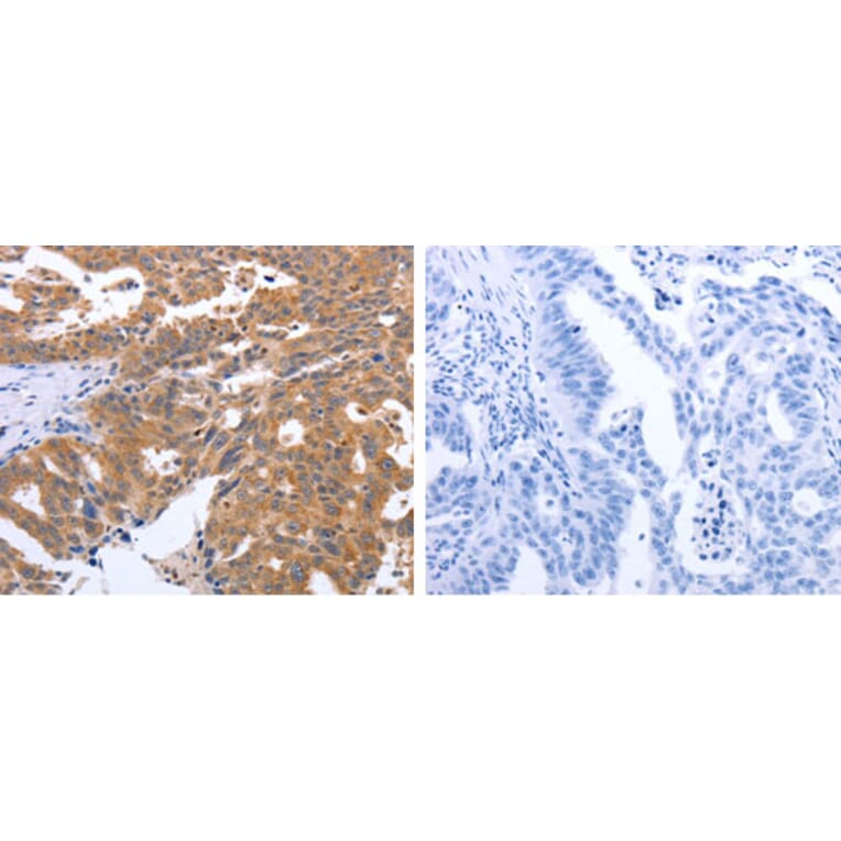GEMIN2 Antibody from Signalway Antibody (31266) - Antibodies.com