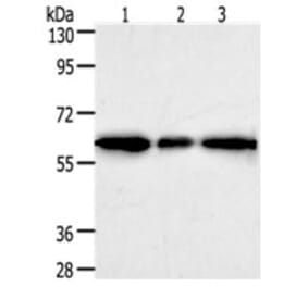 AKR1A1 Antibody from Signalway Antibody (31277) - Antibodies.com