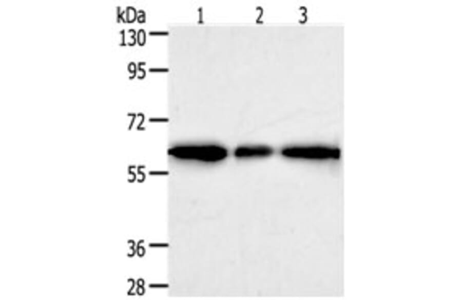 AKR1A1 Antibody from Signalway Antibody (31277) - Antibodies.com