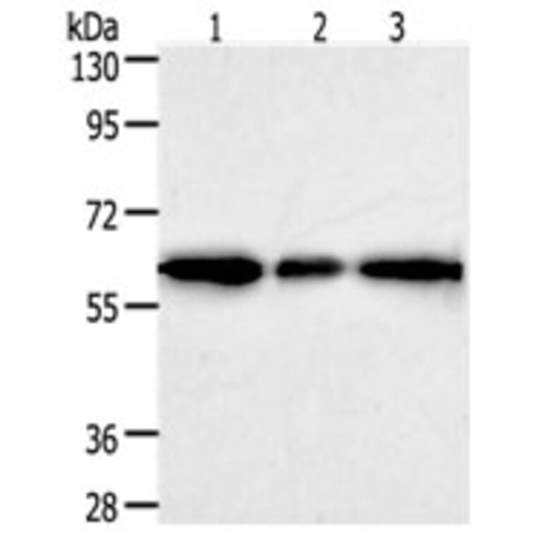 AKR1A1 Antibody from Signalway Antibody (31277) - Antibodies.com