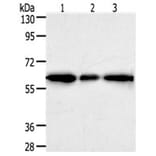 AKR1A1 Antibody from Signalway Antibody (31277) - Antibodies.com