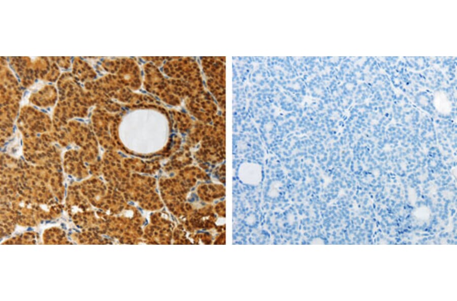 AKR1A1 Antibody from Signalway Antibody (31277) - Antibodies.com