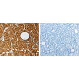 AKR1A1 Antibody from Signalway Antibody (31277) - Antibodies.com