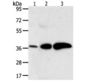 AKR1C1 Antibody from Signalway Antibody (31278) - Antibodies.com