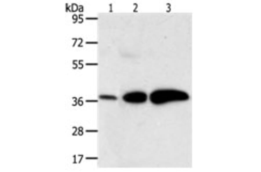 AKR1C1 Antibody from Signalway Antibody (31278) - Antibodies.com