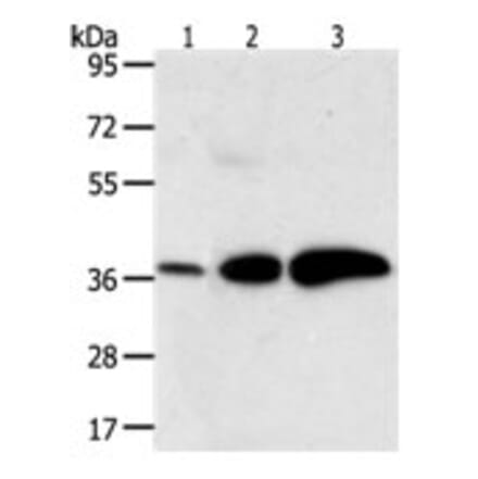 AKR1C1 Antibody from Signalway Antibody (31278) - Antibodies.com