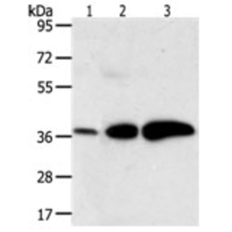AKR1C1 Antibody from Signalway Antibody (31278) - Antibodies.com