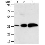 AKR1C1 Antibody from Signalway Antibody (31278) - Antibodies.com