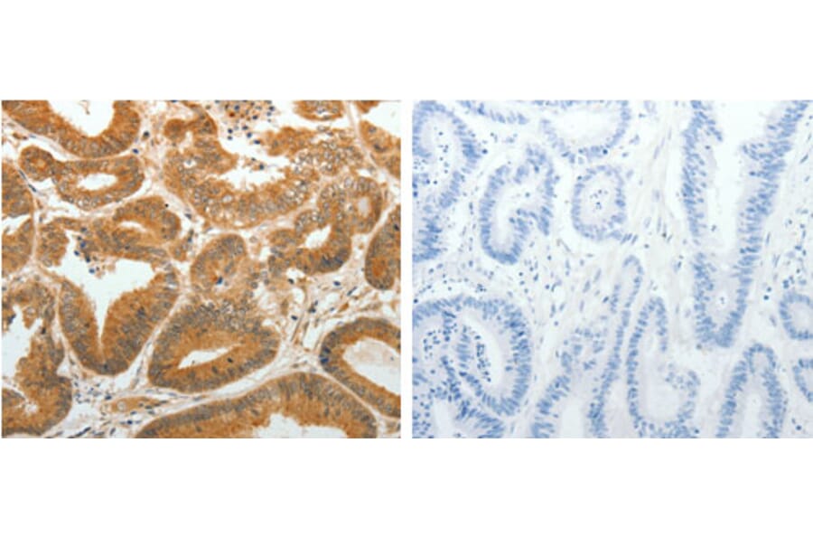 AKR1C1 Antibody from Signalway Antibody (31278) - Antibodies.com