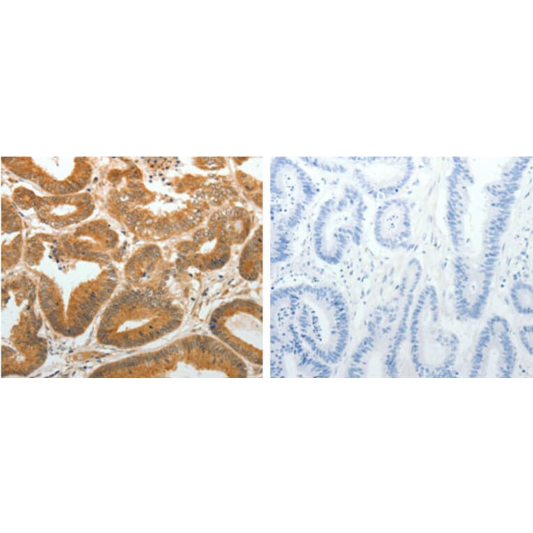 AKR1C1 Antibody from Signalway Antibody (31278) - Antibodies.com