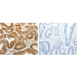 AKR1C1 Antibody from Signalway Antibody (31278) - Antibodies.com