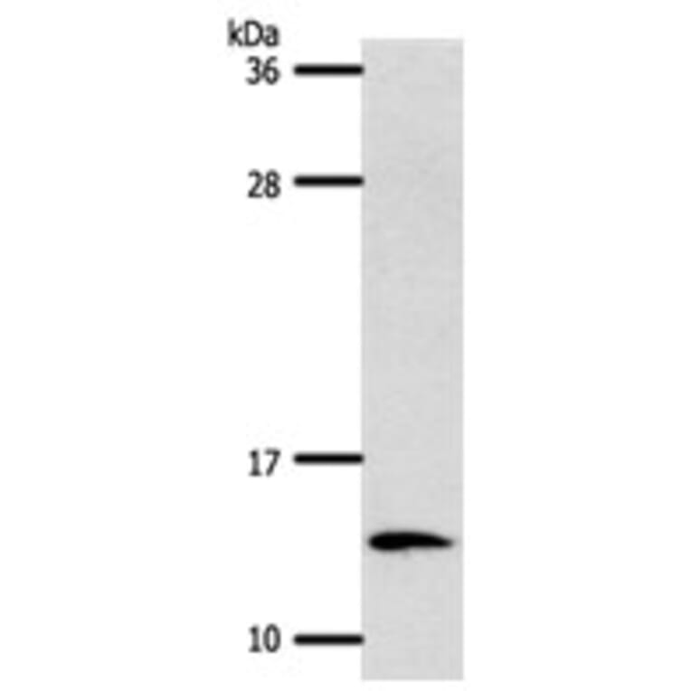 S100A4 Antibody from Signalway Antibody (31289) - Antibodies.com