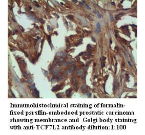 TCF7L2 Antibody from Signalway Antibody (39284) - Antibodies.com