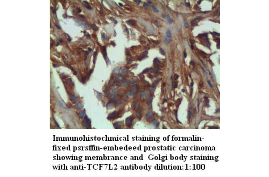 TCF7L2 Antibody from Signalway Antibody (39284) - Antibodies.com