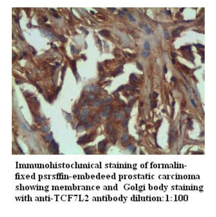 TCF7L2 Antibody from Signalway Antibody (39284) - Antibodies.com