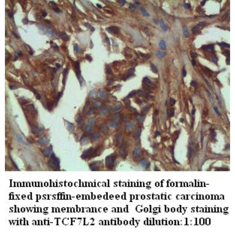 TCF7L2 Antibody from Signalway Antibody (39284) - Antibodies.com