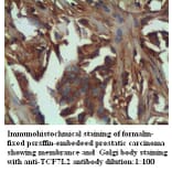 TCF7L2 Antibody from Signalway Antibody (39284) - Antibodies.com